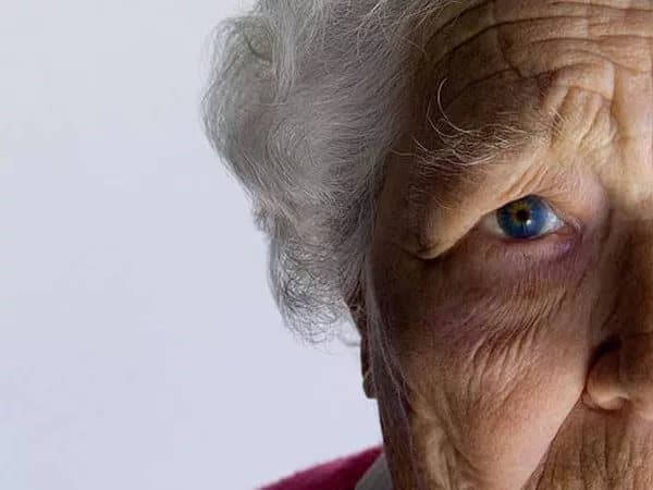 sosudistaya-dementsiya