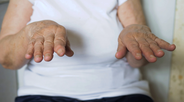 дрожание рук в пожилом возрасте